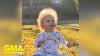 One Year Old Boy Has Extremely Rare Uncombable Hair Syndrome L Gma